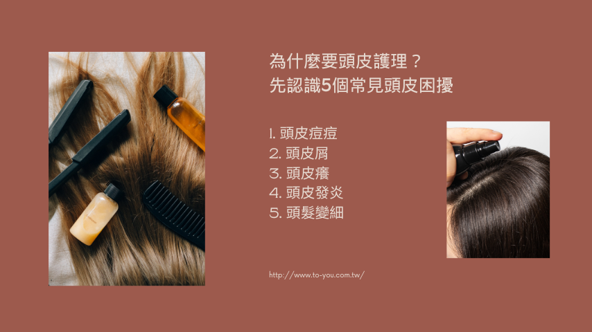 為什麼要頭皮護理?先認識5個常見頭皮困擾